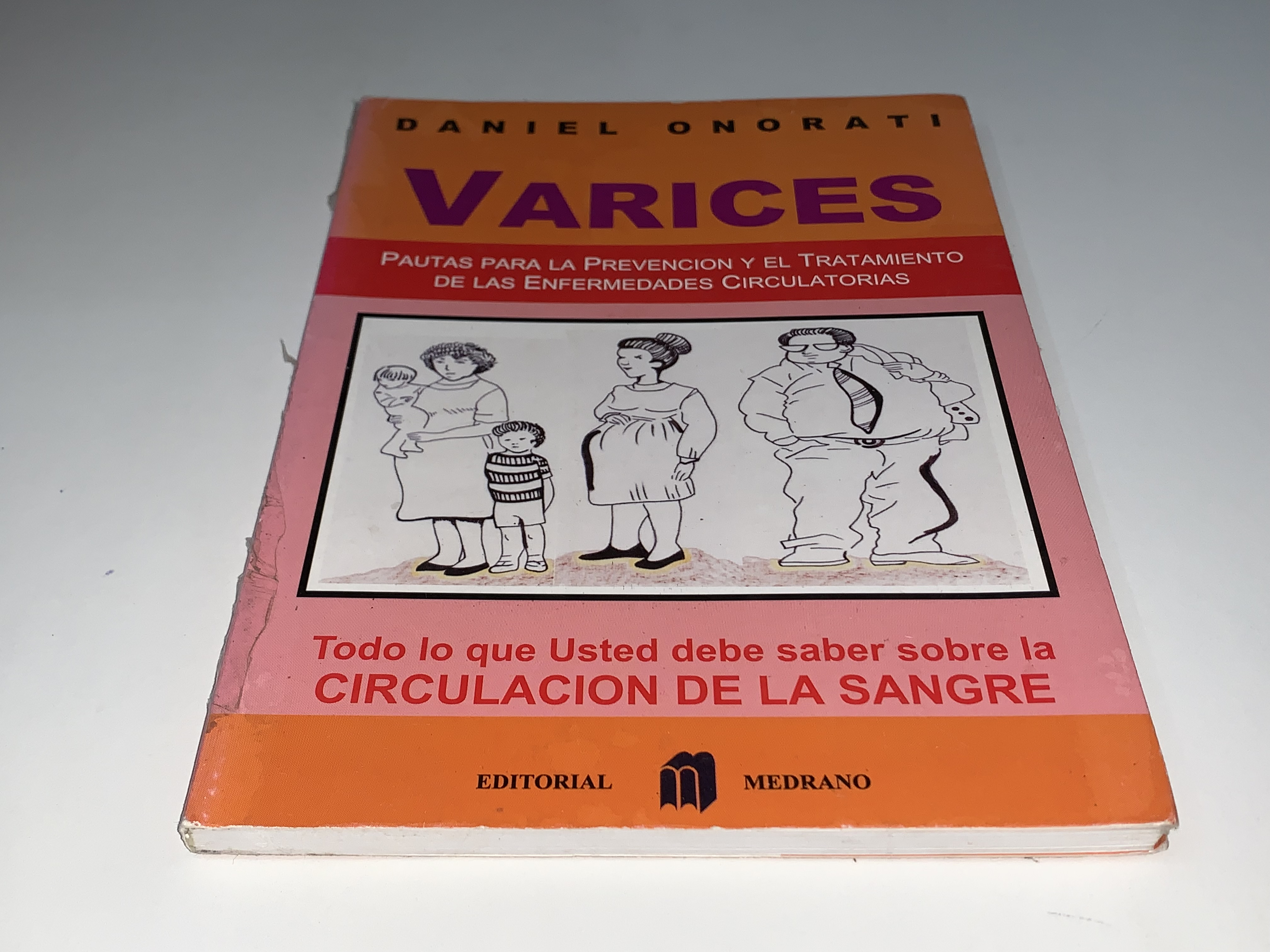 Varices